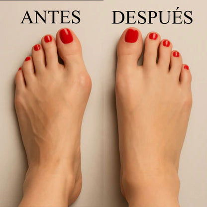 Corrector de juanetes, alivia el dolor y corrige- Huella Bella